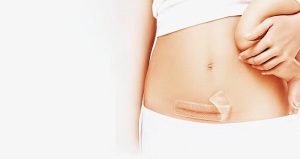 Неліктен қалың силиконды тыртық парақтары соншалықты танымал?