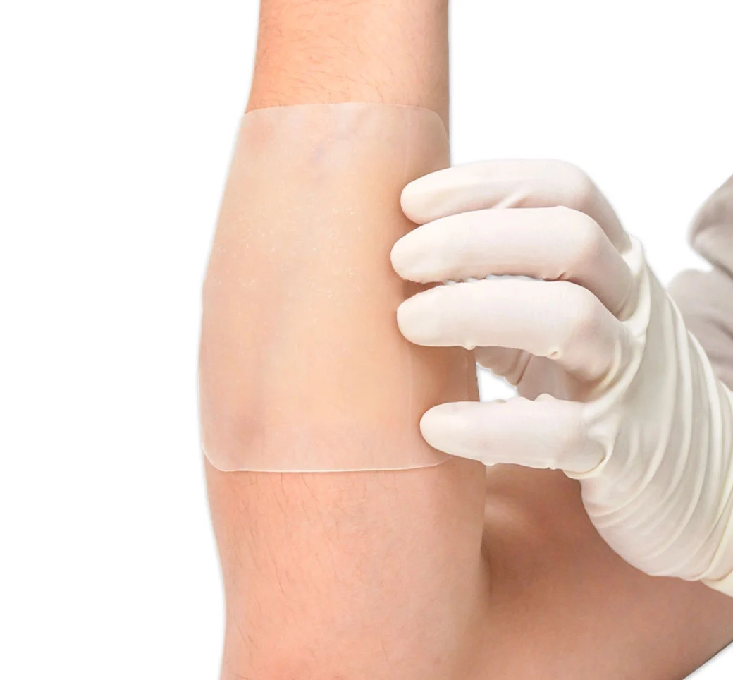 Bordered Hydrocolloid Dressing Roll With Pull Tab For Surgical Wounds