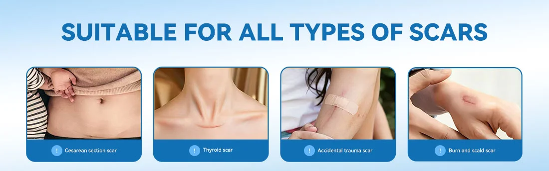 Silicone Gel Waterproof Thickened Scar Paste