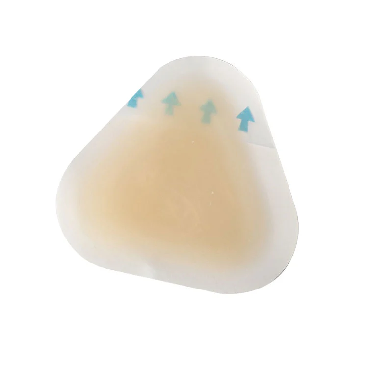 Өкшеге арналған стерильді көпіршіктердің алдын алу